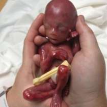 Уникални снимки на бебе, родено в 19-та седмица