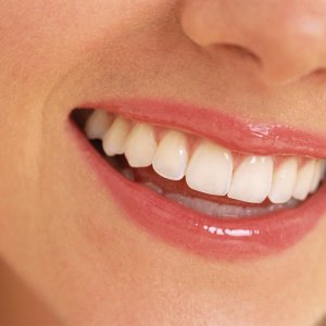 Методи за спиране на кървенето на зъбите