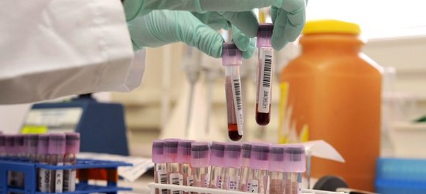 Нов кръвен тест предсказва докога ще живеем