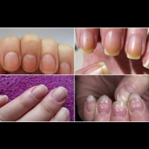 7 важни промени на ноктите, които говорят много за вашето здраве