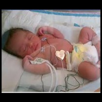 Феномен: Бебе оцеля с помощта на Виагра
