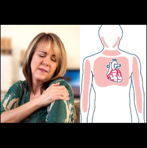 7 предупредителни симптома за инфаркт при жените