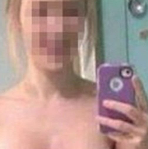 Докъде я докарахме! Българска ученичка си сложи силикон в гърдите и постна снимка във фейсбук с шевовете веднага след операцията