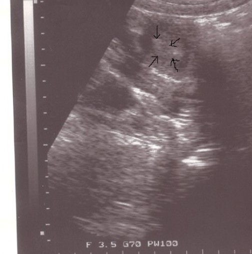 Бременна и лекари останаха шокирани, когато видяха това на видеозона