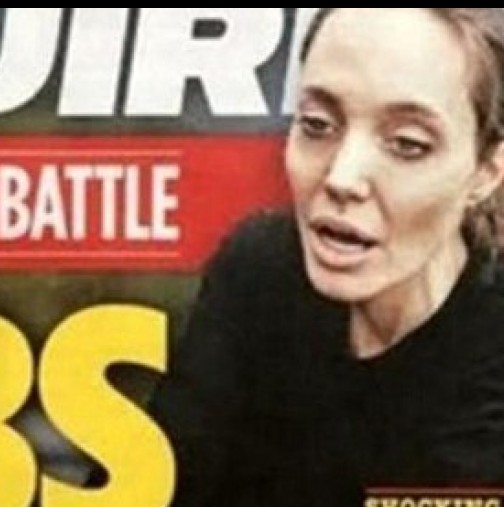 Красивата Анджелина Джоли в болница? Брат Пит притеснен много