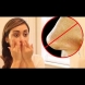 Решете проблемът с ужасните черни точки по носа само с една съставка от кухнята ви (Видео)