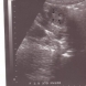 Бременна и лекари останаха шокирани, когато видяха това на видеозона