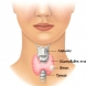 Бързи въпроси за проверка състоянието на щитовидната жлеза при жените