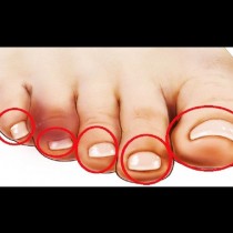 Първи признаци за болест на сърцето: Вижте пръстите на краката си!