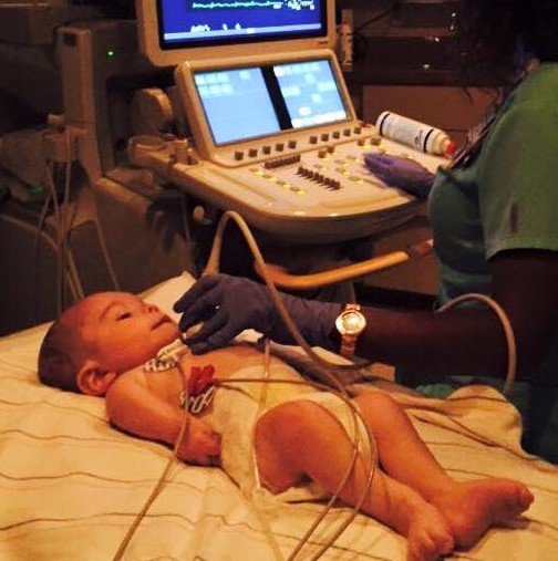 Лекарите забелязват нещо странно и шокиращо в това бебе. 2 години по-късно се случва истинско чудо (Снимки)