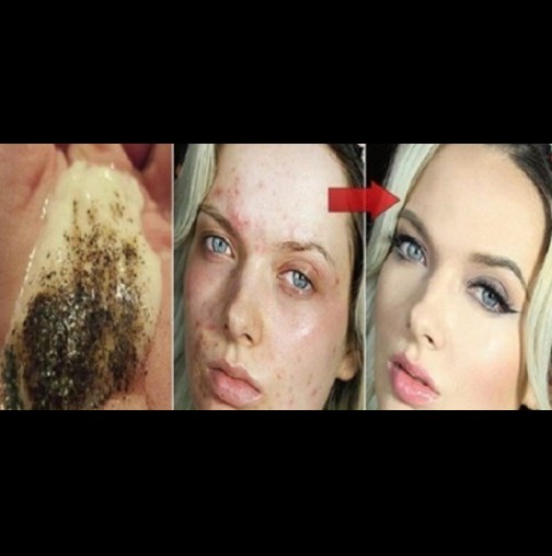Вижте какво ще се случи с вашата кожа само за няколко минути