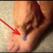Натиснете тази точка на крака си преди лягане и вижте какво се случва с твоето тяло