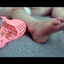 Мами, внимателно при избора на сандали за децата ви! Вижте какво могат да причинят те на нежните детски крачета (СНИМКИ):