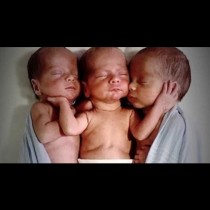 Невероятна рядкост: Родила еднояйчни тризнаци, но вижте какво ги различава ...