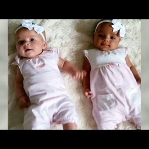 Майка ражда близначки, но момиченцата изумяват лекарите. Каква е причината