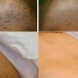Доживотна епилация: Чудесен трик за спасение от нежеланото окосмяване!