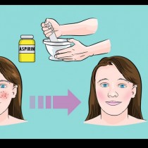 Стрийте няколко таблетки аспирин и ги поставете на лицето си! Ще решите проблем, който ви тормози отдавна! 