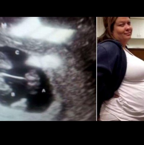 Майка на 4 деца е бременна отново. Тогава лекарите се вглеждат по-внимателно и виждат...