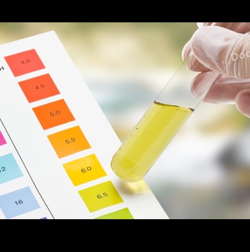 Не е необходимо да я давате на анализ-Цветът на урината показва от цистит – до рак