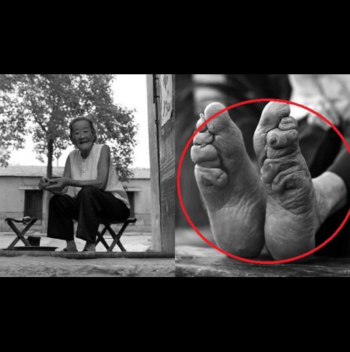 Последната жива жена с "лотосови" крака пази спомена за тази зверска традиция
