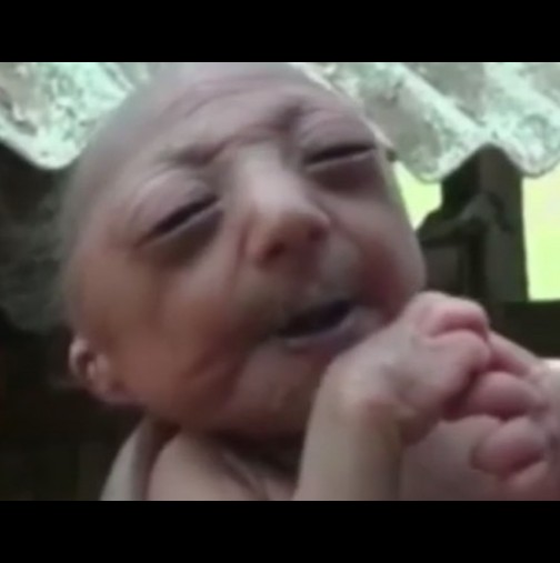 Роди се бебе-старец: Майката отказва да го кърми, но след това се случва нещо прекрасно!