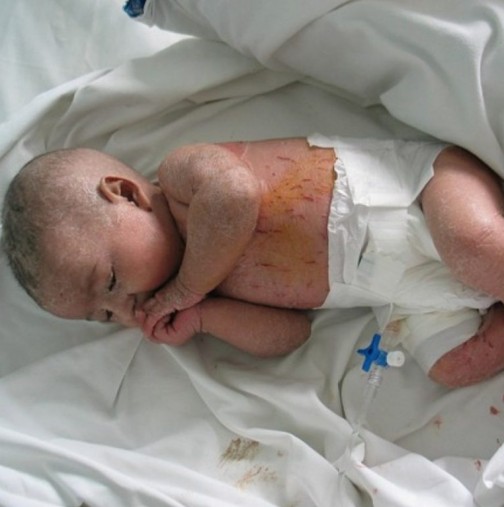 Такова нещо не сте чували! Майка осоли тримесечното си бебе! Лекари в Стара Загора се борят за живота му!