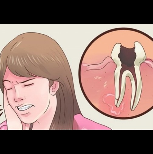 Отървете се от зъбобол за 1 секунда: Ще ви мине веднага, бъдете благодарни, че сте открили този лек!