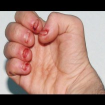Ако някой  си гризе ноктите, предупредете го, защото може да се случи нещо лошо