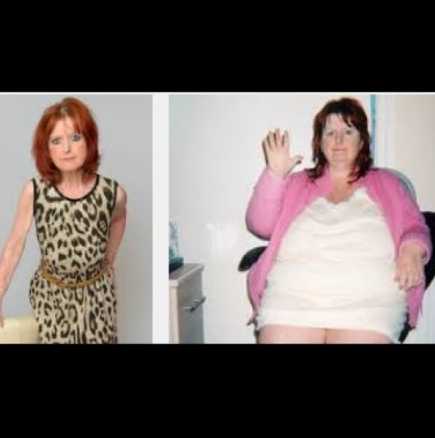 51-годишна жена успя да свали 100 килограма 