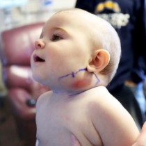 Това малко сладко бебенце постоянно се почесвало по бузката, докато не му се подула и отишли на лекар