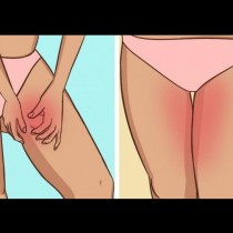 Как да предотвратите триенето между краката си