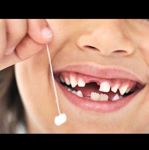 Пазите ли млечните зъбки на децата си? Не само заради Феята на зъбките, има и друга сериозна причина да го правите