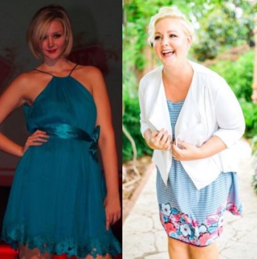 Нейните снимки "преди и сега" показват, че стопяването на килограми не винаги носи щастие