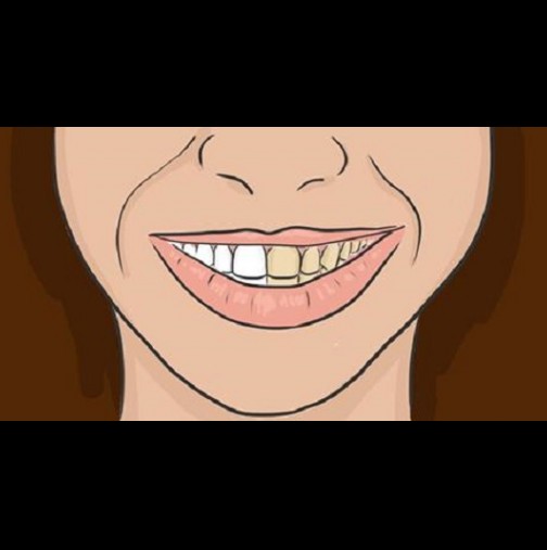 Правя това всеки път, преди да си измия зъбите! Невероятно бели са - даже забравих как изглежда зъболекарят ми!