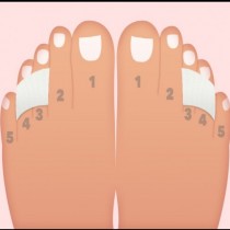 Сложете лепенка на третия и четвъртия пръст на крака заедно-Значително намалява болката на сводовете на краката