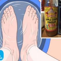 Рецепта с английска сол и ябълков оцет -Вана за болезнени стъпала-Облекчава болката на 20-тата минута!