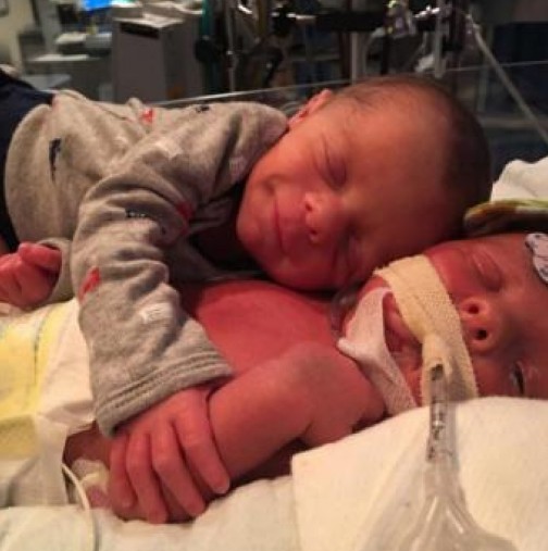 Снимка която разплака света: Новородено прегръща своето болно братче близначе