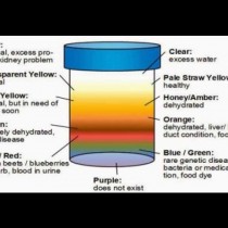Разберете какво разкрива цветът на урината Ви за Вашето здраве и кога има повод за притеснение