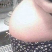 48-годишна жена смяташе че е бременна, но това продължи 3 години и накрая не извадиха бебе от нея, а ето това!