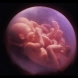 Заснеха как бебе близнак целува по челото другото бебе в корема на майката