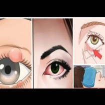 Тези общи нарушения могат да доведат до сериозно заболяване на очите