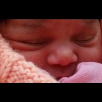 Запознайте се с малката Ана! Тя има най-уникалния родилен белег, който сте виждали (Снимки)