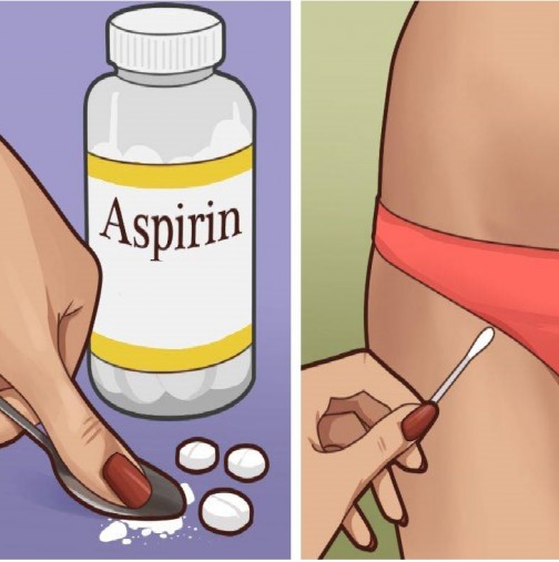 Естествен начин за решаване на най-големия проблем на интимните части с използване на аспирин!