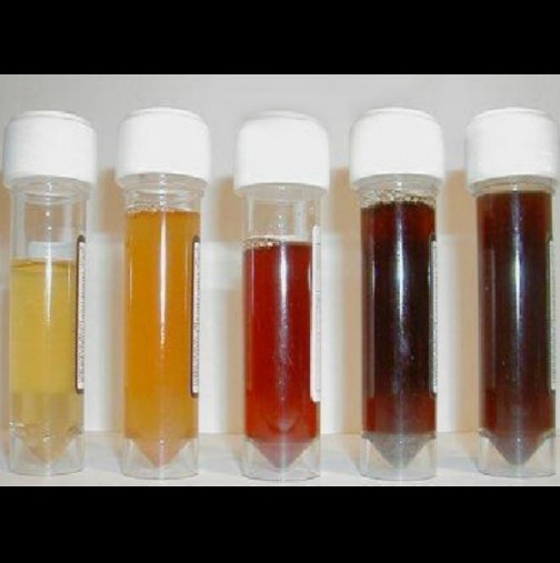 Какъв е цветът на урината от цистит до рак. Важна информация за състоянието на организма