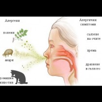 Ето как да разберете, че със сигурност страдате от алергия