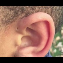 Някои хора са родени с дупки над ушите-Какво означава това?