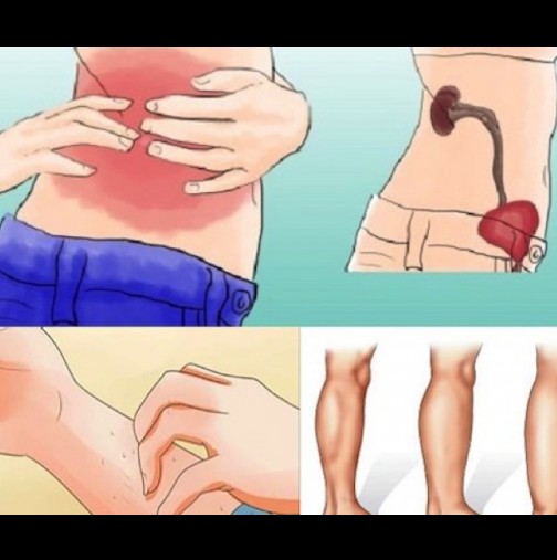 Ако бъбреците ви са в опасност, тялото ви ще има тези 8 признаци!