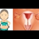 Жените трябва да са наясно: Това разрушава яйчниците и репродуктивната система!