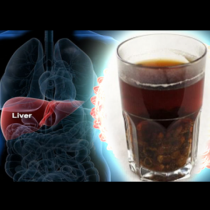 Майка ми имаше проблеми с черния дроб и започна сама да си приготвя тази напитка. Скоро лекарите казаха, че е пречистен напълно
