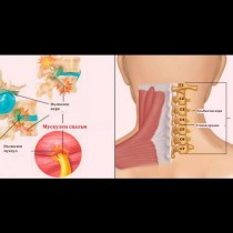 Мъчих се като грешен дявол: всяко движение беше кошмар! Оказа се толкова просто - завърташ глава и болката изчезва!